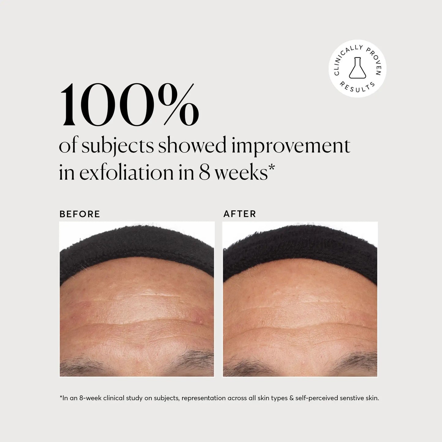 azelaic-acid-derivative-complex-10-e5 NATR-10023-Alt-Images-Azelaic-Acid-Derivative-Complex-10_-03.webp
