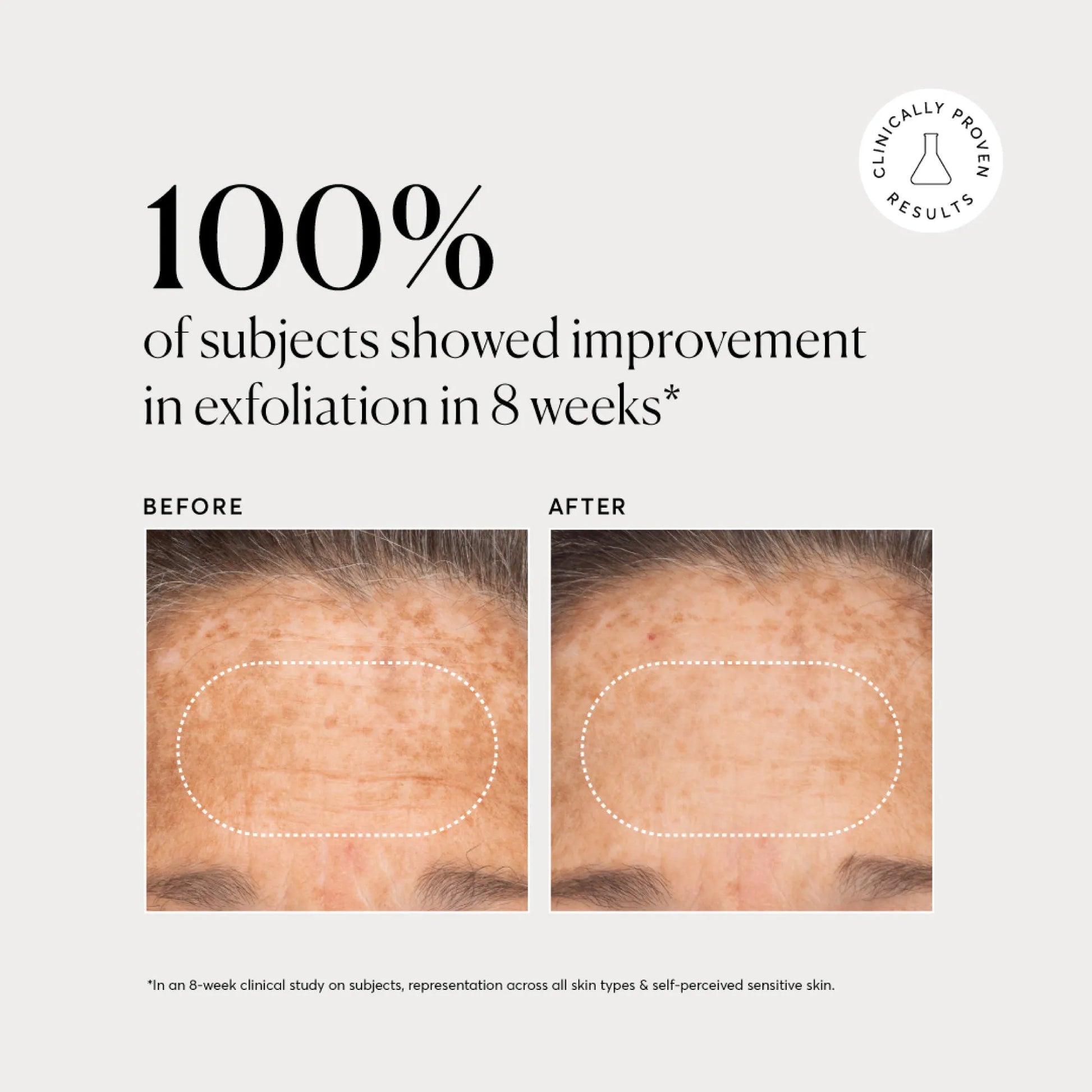 bha-liquid-exfoliant-2-v9 NATR-10027-Alt-Images-BHA-Liquid-Exfoliant-2_-03.webp